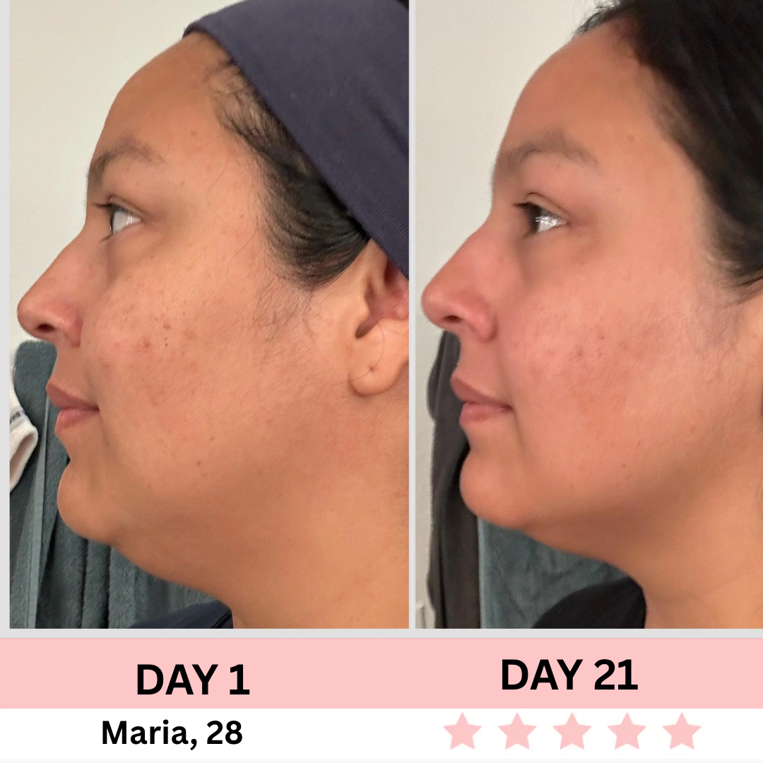 EMS Facial Sculptor - SilkyLift™