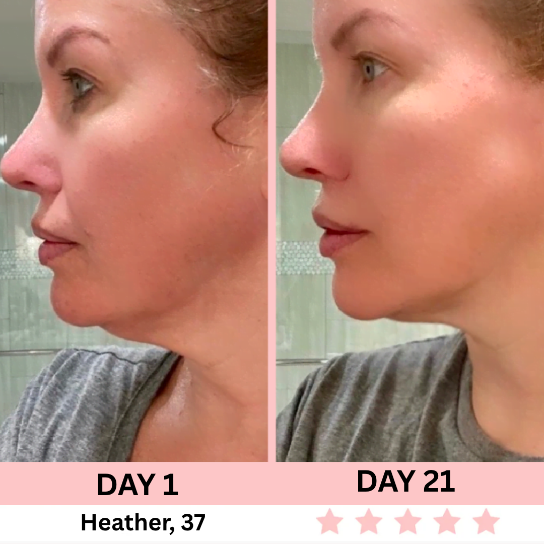 EMS Facial Sculptor - SilkyLift™