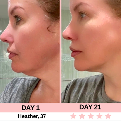EMS Facial Sculptor - SilkyLift™